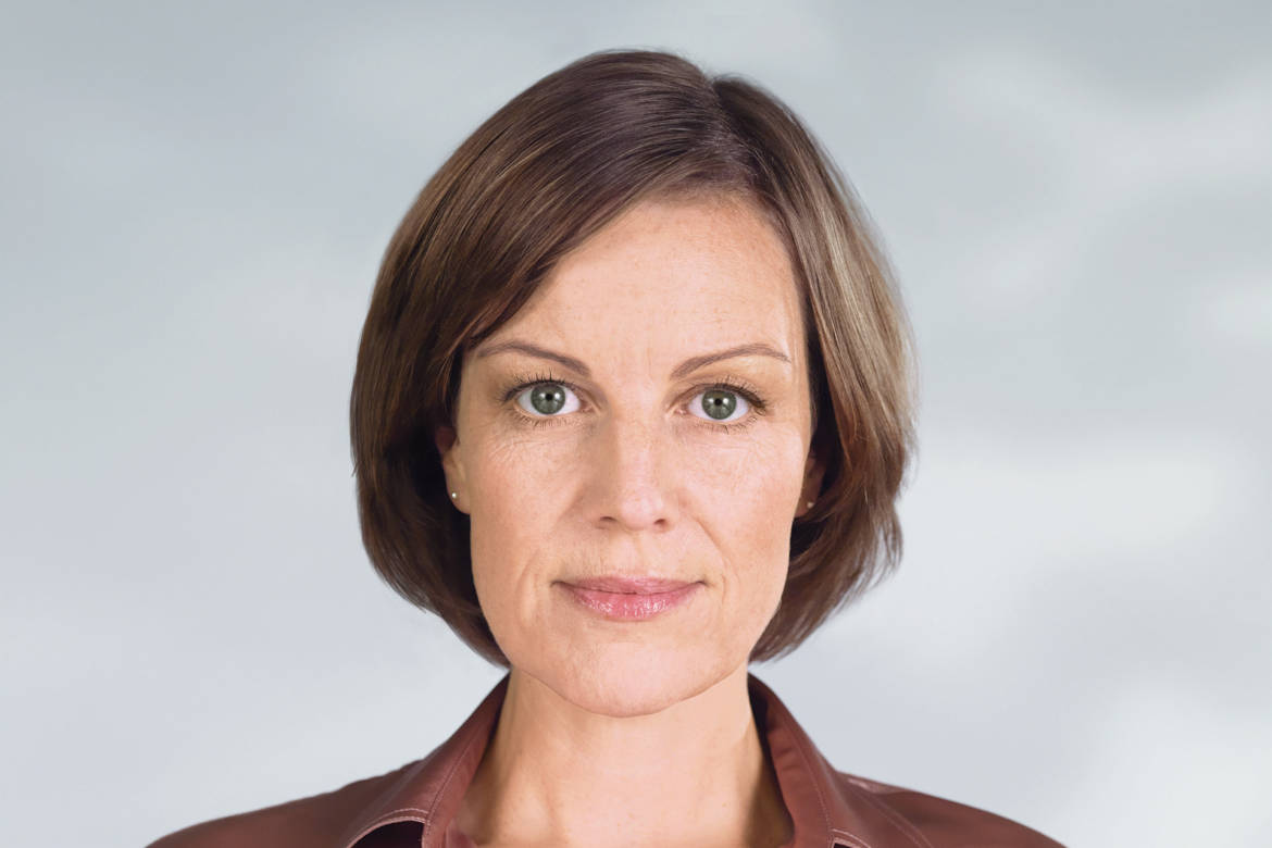 franca-after-sculptra.jpg