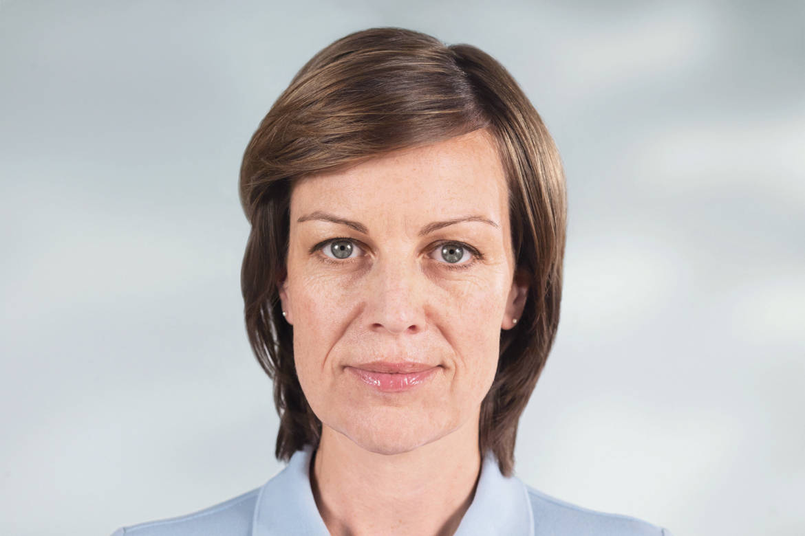 franca-before-sculptra.jpg