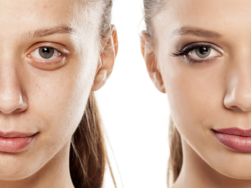 transformation-face-skin.jpg